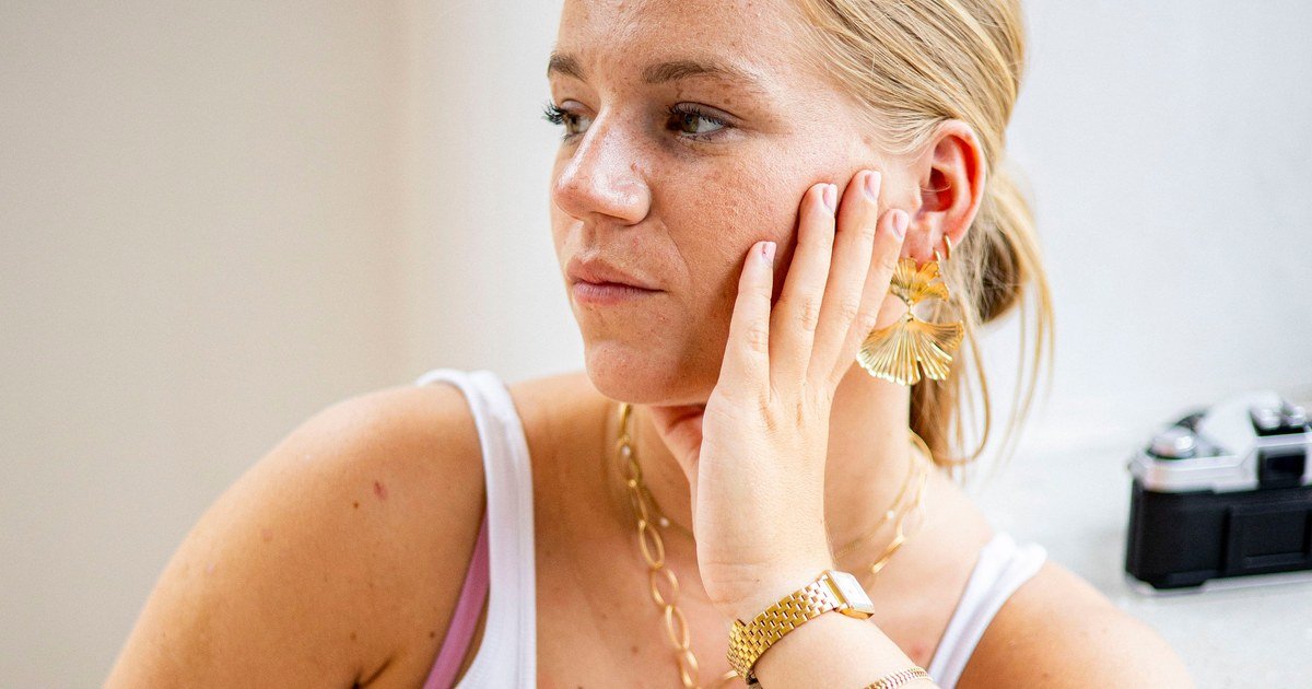 Blonde Frau mit goldenem Ohrring berührt nachdenklich ihre Wange, trägt weißes Top und goldene Armbanduhr.